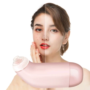 Hudorm Remover Instrument El-Sort Prik Suge-Enheden Skønhed Af Ansigt Dyb Næse Pore Renere Acne Bums Fjernelse